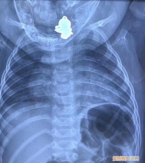 解雨臣的四只吞金兽分别是谁 9个月的吞金兽吞下个金宝宝