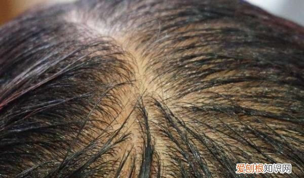 剪发虫怎么除掉,怎样去除剪发虫长什么样