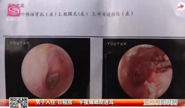 男子三天没睡觉去医院一查崩溃了