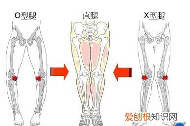 什么样的走路姿势会导致O型腿 5种走路姿势会让你变成O型腿