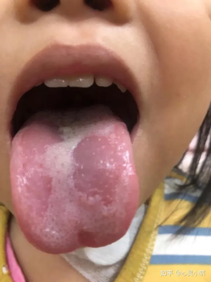 大小Ann，小Ann系列：9月，夏去秋来，正确的育儿常识，不再为健康买单