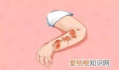 蚊子咬的疤怎么好的快 蚊子咬的疤怎么好