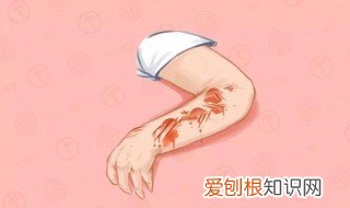 蚊子咬的疤怎么好的快 蚊子咬的疤怎么好