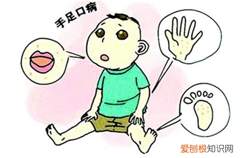 跟手足口病儿童接触了怎么办 手口足病一般几天好