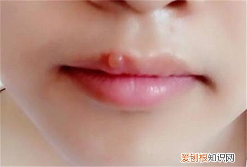 嘴上起泡怎样快速下去嘴上起泡可以涂牙膏吗