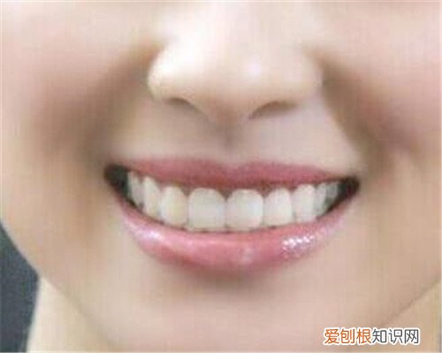 自锁托槽有哪些优点 托槽掉了要怎么处理