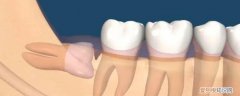 牙根指的是哪里 什么是寻根牙 寻根牙是什么意思