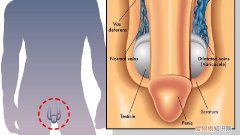 男性早泄和体质有关，男性早泄的预防方法，男性早些泄的原因