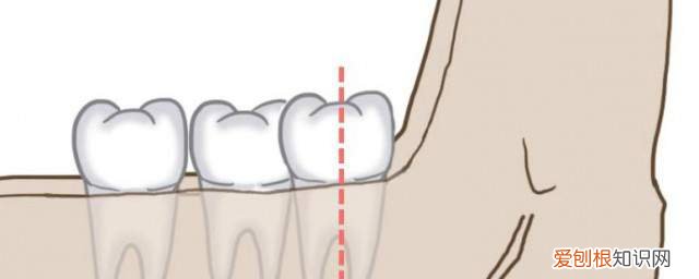 智齿为什么会很痛 智齿为什么会疼（智齿会疼的原因