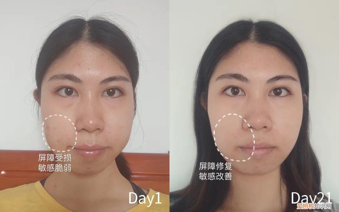 hr赫莲娜小绿瓶适合什么年龄的用?