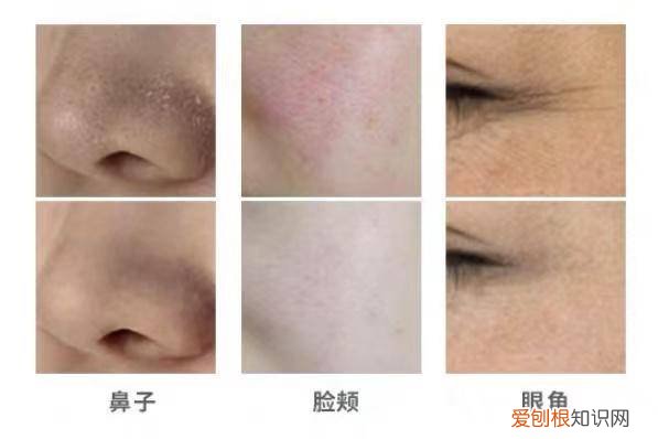 软水机究竟值不值得买