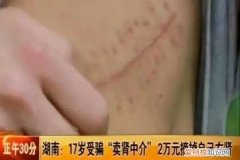 虚荣高中生“卖肾”换苹果手机，如今人和身体都“废了”，用肾换手机的高中生