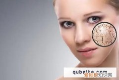 秋季皮肤缺水 春季皮肤为什么缺水,春季皮肤缺水的原因