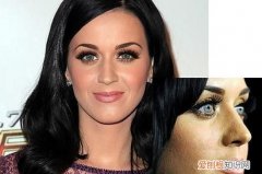 闭口粉刺会变大吗 ，闭口粉刺会慢慢消失吗？