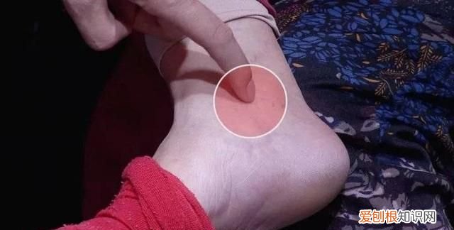 莲子去芯还是苦能吃吗 莲子去掉芯了还清热降火吗