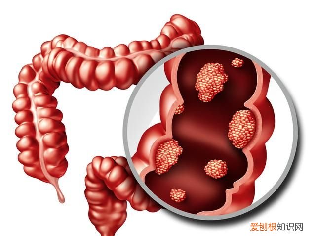 从大便颜色来诊断肠胃的病变
