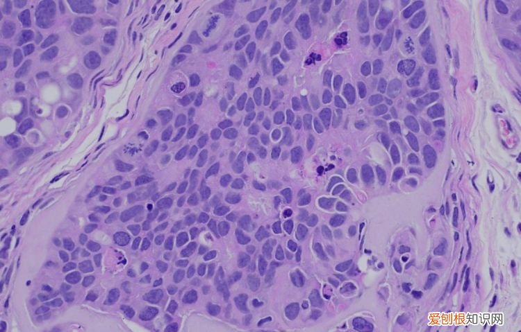 he染色原理是什么，he染色方法什么叫he染色法呢