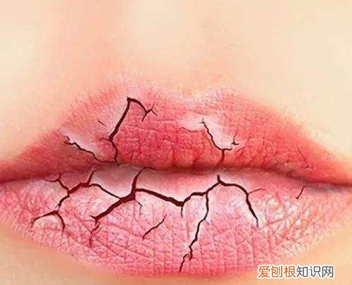冬天嘴唇很干怎么办，冬天嘴唇干裂最快解决办法
