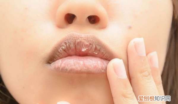 冬天嘴唇很干怎么办，冬天嘴唇干裂最快解决办法