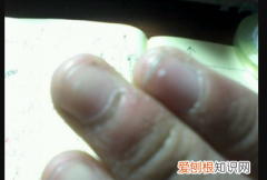 指甲有白色的小块怎么回事，手指甲边缘开裂是什么原因