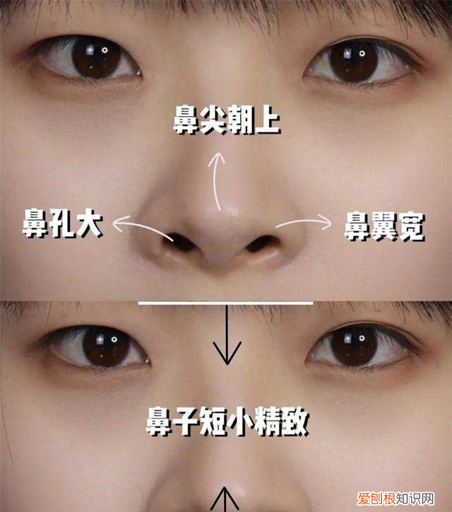 塌鼻子鼻孔大怎么做好看