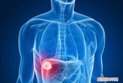 可溶性膳食纤维导致肝癌 可溶性膳食纤维吃多了会得肝癌