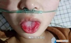 河北邢台18岁女孩被姐夫投毒百草枯，简直丧心病狂