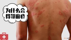 2岁宝宝出疹子的类型