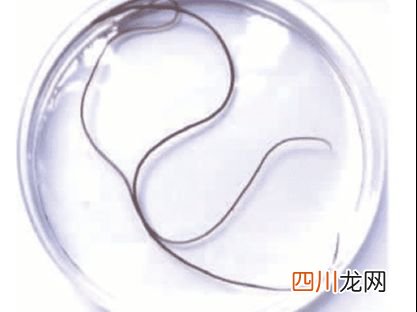 铁线虫是什么?有什么危害? 铁线虫的百度百科