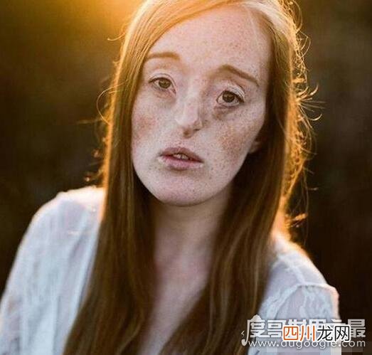 组图 世界上最丑女模特盘点，梅勒妮·盖多斯最值得敬佩