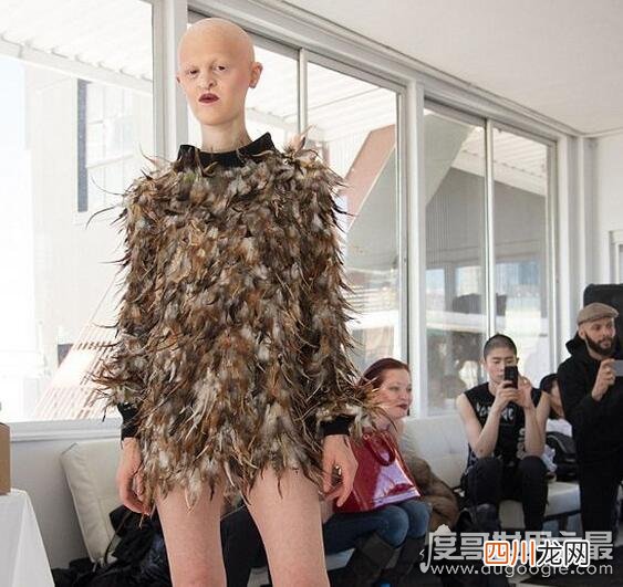 组图 世界上最丑女模特盘点，梅勒妮·盖多斯最值得敬佩