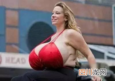 手指头最多的人 印度男子共有28根手指和脚趾创纪录