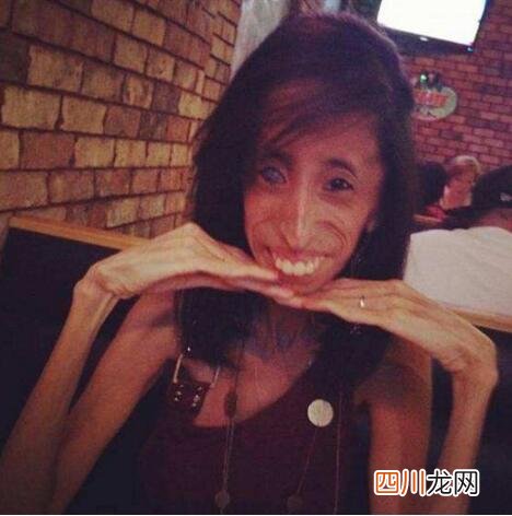 体重仅仅只有54斤 美国零脂肪女孩，丽兹·维拉斯奎兹