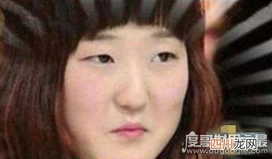 世界上最小的嘴巴，崔智善的樱桃小嘴仅3cm吃东西困难