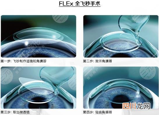 很多原因从中决定着价格高低 做激光飞秒手术的价格
