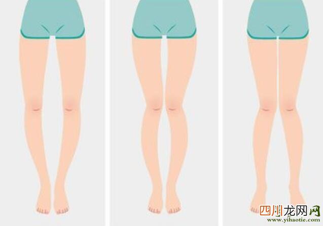 公认的4种最丑腿型，看看你是不是 世界上最丑的腿图片