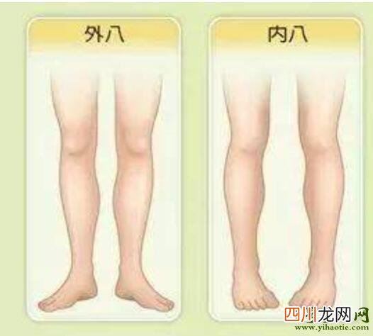公认的4种最丑腿型，看看你是不是 世界上最丑的腿图片