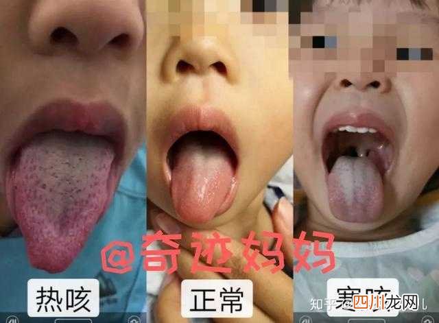 有什么好办法能治愈咳嗽 咳嗽怎么治最快最有效