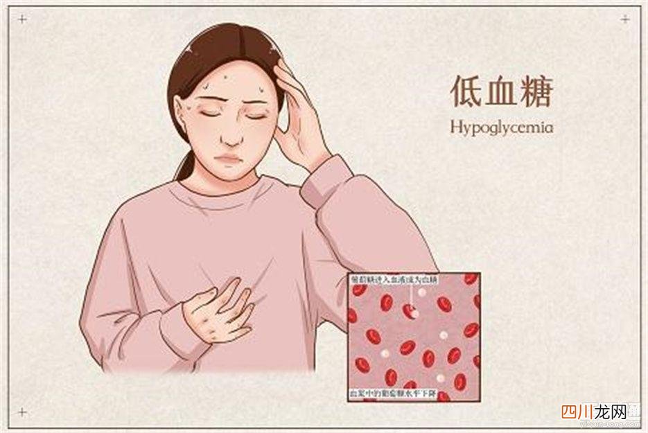 低血糖的症状 低血糖的症状或表现